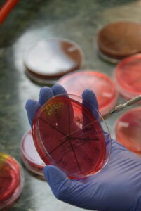 ręka w rękawicy lateskowej podczas badania próbówki mikrobiologicznej